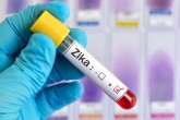 3 проверенных факта о том, как передается вирус Зика